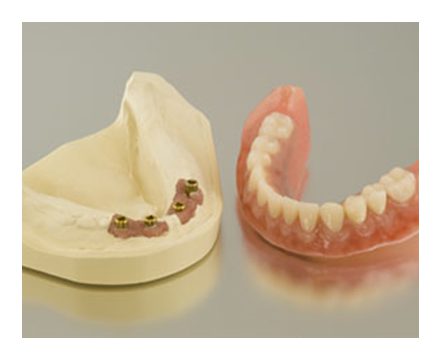 Sedation Dentistry